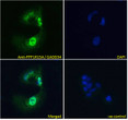 STJ70012 Immunofluorescence analysis of paraformaldehyde fixed HepG2 cells, permeabilized with 0. 15% Triton. Primary incubation 1hr (10ug/ml) followed by Alexa Fluor 488 secondary antibody (4ug/ml) , showing strong nuclear and some cytoplasmic staining. The nuclear stain is DAPI (blue). Negative control: Unimmunized goat IgG (10ug/ml) followed by Alexa Fluor 488 secondary antibody (4ug/ml).