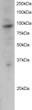 STJ70059 staining (2µg/ml) of Jurkat lysate (RIPA buffer, 30µg total protein per lane). Primary incubated for 12 hour. Detected by western blot using chemiluminescence.