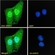 STJ70103 Immunofluorescence analysis of paraformaldehyde fixed U2OS cells, permeabilized with 0. 15% Triton. Primary incubation 1hr (10ug/ml) followed by Alexa Fluor 488 secondary antibody (2ug/ml) , showing nuclear and cytoplasmic staining. The nuclear stain is DAPI (blue). Negative control: Unimmunized goat IgG (10ug/ml) followed by Alexa Fluor 488 secondary antibody (2ug/ml).
