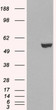 HEK293 overexpressing IRF6 (RC201579) and probed with STJ70159 (mock transfection in first lane) , tested by Origene.