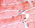 STJ70330 (1. 25µg/ml) staining of paraffin embedded Human Skeletal Muscle. Steamed antigen retrieval with citrate buffer pH 6, AP-staining.