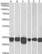 STJ70331 (0. 001µg/ml) staining of Human Cerebellum (A) , Human Frontal Cortex (B) , Human Hippocampus (C) Mouse Fetal Brain (D) , Mouse Brain (E) and Rat Brain (F) lysates (35µg protein in RIPA buffer). Detected by chemiluminescence.