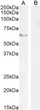 STJ70385 staining (2µg/ml) of nuclear HEK293 (A) and (1ug/ml) negative control Human Pancreas (B) lysate [RIPA buffer, 35µg total protein per lane). Detected by chemiluminescence.