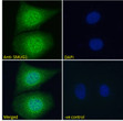 STJ70525 Immunofluorescence analysis of paraformaldehyde fixed MCF7 cells, permeabilized with 0. 15% Triton. Primary incubation 1hr (10ug/ml) followed by Alexa Fluor 488 secondary antibody (2ug/ml) , showing strong nuclear and cytoplasmic staining. The nuclear stain is DAPI (blue). Negative control: Unimmunized goat IgG (10ug/ml) followed by Alexa Fluor 488 secondary antibody (2ug/ml).