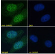 STJ70525 Immunofluorescence analysis of paraformaldehyde fixed U2OS cells, permeabilized with 0. 15% Triton. Primary incubation 1hr (10ug/ml) followed by Alexa Fluor 488 secondary antibody (2ug/ml) , showing strong nuclear staining. The nuclear stain is DAPI (blue). Negative control: Unimmunized goat IgG (10ug/ml) followed by Alexa Fluor 488 secondary antibody (2ug/ml).