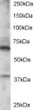STJ70547 staining (0. 5µg/ml) of Jurkat lysate (RIPA buffer, 35µg total protein per lane). Primary incubated for 1 hour. Detected by western blot using chemiluminescence.