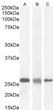 STJ70567 (0. 03µg/ml) staining of A431 (A) , (0. 5ug/ml) HeLa (B) and (0. 1ug/ml) MCF7 (C) cell lysate (35µg protein in RIPA buffer). Detected by chemiluminescence.