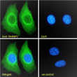 STJ70567 Immunofluorescence analysis of paraformaldehyde fixed HEK293 cells, permeabilized with 0. 15% Triton. Primary incubation 1hr (10ug/ml) followed by Alexa Fluor 488 secondary antibody (2ug/ml) , showing cytoplasmic staining. The nuclear stain is DAPI (blue). Negative control: Unimmunized goat IgG (10ug/ml) followed by Alexa Fluor 488 secondary antibody (2ug/ml).