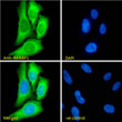 STJ70567 Immunofluorescence analysis of paraformaldehyde fixed HeLa cells, permeabilized with 0. 15% Triton. Primary incubation 1hr (10ug/ml) followed by Alexa Fluor 488 secondary antibody (2ug/ml) , showing cytoplasmic staining. The nuclear stain is DAPI (blue). Negative control: Unimmunized goat IgG (10ug/ml) followed by Alexa Fluor 488 secondary antibody (2ug/ml).