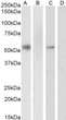 STJ70605 (0. 3µg/ml) staining of nuclear HeLa cell lysate (A) + peptide (B) and nuclear K562 cell lysate (C) + peptide (D). (35µg protein in RIPA buffer). Detected by chemiluminescence.