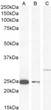 STJ70636 (0. 5ug/ml) staining of MCF7 (A) , (1ug/ml) U251 cell lysate 1 (B) and U251 cell lysate 2 (C) (35µg protein in RIPA buffer) Detected by chemiluminescence. STJ70636 (0. 5ug/ml) staining of MCF7 (A) , (1ug/ml) U251 cell lysate 1 (B) and U251 cell lysate 2 (C) (35µg protein in RIPA buffer) Detected by chemiluminescence.