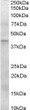 STJ70679 (0. 3µg/ml) staining of Human Pancreas lysate (35µg protein in RIPA buffer). Detected by chemiluminescence.
