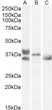 STJ70700 (1µg/ml) staining of Human Heart (A) , Mouse Heart (B) , Rat Heart (C) lysates (35µg protein in RIPA buffer). Detected by chemiluminescence.