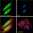 STJ70702 Immunofluorescence analysis of paraformaldehyde fixed HeLa cells, permeabilized with 0. 15% Triton. Primary incubation 1hr (10ug/ml) followed by Alexa Fluor 488 secondary antibody (2ug/ml) , showing cytoplasmic and nuclear staining. Actin filaments were stained with phalloidin (red) and the nuclear stain is DAPI (blue). Negative control: Unimmunized goat IgG (10ug/ml) followed by Alexa Fluor 488 secondary antibody (2ug/ml).