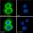 STJ70702 Immunofluorescence analysis of paraformaldehyde fixed A431 cells, permeabilized with 0. 15% Triton. Primary incubation 1hr (10ug/ml) followed by Alexa Fluor 488 secondary antibody (2ug/ml) , showing cytoplasmic staining. The nuclear stain is DAPI (blue). Negative control: Unimmunized goat IgG (10ug/ml) followed by Alexa Fluor 488 secondary antibody (2ug/ml).