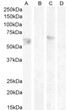 STJ70782 (1µg/ml) staining of HeLa lysate non-glycosylated (A) + peptide (B) and (0. 5ug/ml) HeLa lysate glycosylated (C) + peptide (D) , (35µg protein in RIPA buffer). Detected by chemiluminescence.