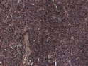 STJ70891 (8µg/ml) staining of paraffin embedded Human Ovary. Heat induced antigen retrieval with citrate buffer pH 6, HRP-staining.