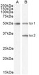 STJ70936 (2µg/ml) staining of isoform 1 Human Brain (A) and isoform 1+2 (B) lysate (35µg protein in RIPA buffer). Detected by chemiluminescence.