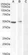 STJ71122 (0. 5µg/ml) staining of Jurkat (A) , (0. 3ug/ml) PBM (B) and negative control A431 (C) cell lysate (35µg protein in RIPA buffer). Detected by chemiluminescence.