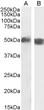 STJ71122 (2µg/ml) staining of Human Spleen (A) and Mouse Thymus (B) lysate (35µg protein in RIPA buffer). Detected by chemiluminescence.