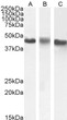 STJ71160 (1µg/ml) staining of A431 (A) , HeLa (B) and K562 (C) nuclear cell lysate (35µg protein in RIPA buffer). Detected by chemiluminescence.