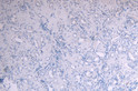 STJ71218 Negative Control showing staining of paraffin embedded Human Kidney, with no primary antibody.