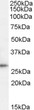 STJ71300 (1µg/ml) staining of Human Lymph Node lysate (35µg protein in RIPA buffer). Detected by chemiluminescence.