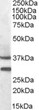 STJ71515 (0. 3µg/ml) staining of Mouse Muscle lysate (35µg protein in RIPA buffer). Detected by chemiluminescence.