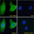STJ71522 Immunofluorescence analysis of paraformaldehyde fixed HeLa cells, permeabilized with 0. 15% Triton. Primary incubation 1hr (10ug/ml) followed by Alexa Fluor 488 secondary antibody (2ug/ml) , showing Mitochondria/cytoplasmic staining. The nuclear stain is DAPI (blue). Negative control: Unimmunized goat IgG (10ug/ml) followed by Alexa Fluor 488 secondary antibody (2ug/ml). STJ71522 Immunofluorescence analysis of paraformaldehyde fixed HeLa cells, permeabilized with 0. 15% Triton. Primary incubation 1hr (10ug/ml) followed by Alexa Fluor 488 secondary antibody (2ug/ml) , showing Mitochondria/cytoplasmic staining. The nuclear stain is DAPI (blue). Negative control: Unimmunized goat IgG (10ug/ml) followed by Alexa Fluor 488 secondary antibody (2ug/ml).