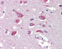 STJ71558 (5µg/ml) staining of paraffin embedded Human Cortex. Steamed antigen retrieval with citrate buffer pH 6, AP-staining.