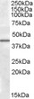 STJ71852 (0. 5µg/ml) staining of Human Liver lysate (35µg protein in RIPA buffer). Primary incubation was 1 hour. Detected by chemiluminescence.