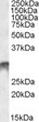 STJ71885 (1µg/ml) staining of Human Bone Marrow lysate (35µg protein in RIPA buffer). Detected by chemiluminescence.