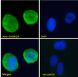 STJ71922 Immunofluorescence analysis of paraformaldehyde fixed U2OS cells, permeabilized with 0. 15% Triton. Primary incubation 1hr (10ug/ml) followed by Alexa Fluor 488 secondary antibody (2ug/ml) , showing membrane staining. The nuclear stain is DAPI (blue). Negative control: Unimmunized goat IgG (10ug/ml) followed by Alexa Fluor 488 secondary antibody (2ug/ml).