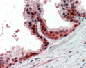STJ71926 (2. 5µg/ml) staining of paraffin embedded Human Prostate. Steamed antigen retrieval with citrate buffer pH 6, AP-staining.