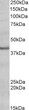 STJ72237 (0. 2µg/ml) staining of Human Heart lysate (35µg protein in RIPA buffer). Primary incubation was 1 hour. Detected by chemiluminescence.