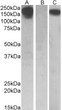 HEK293 lysate (10ug protein in RIPA buffer) overexpressing Human CSF1R with C-terminal MYC tag probed with STJ72332 (0. 5ug/ml) in Lane A and probed with anti-MYC Tag (1/1000) in lane C. Mock-transfected HEK293 probed with STJ72332 (1mg/ml) in Lane B. Primary incubations were for 1 hour. Detected by chemiluminescence.