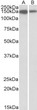 STJ72334 (1µg/ml) staining of Jurkat (A) and Human Thymus (B) lysates (35µg protein in RIPA buffer). Primary incubation was 1 hour. Detected by chemiluminescence.