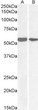 STJ72449 (0. 1µg/ml) staining of lysate of cell line colorectal adenocarcinoma (A) and HeLa (B) (35µg protein in RIPA buffer). Detected by chemiluminescence. STJ72449 (0. 1µg/ml) staining of lysate of cell line colorectal adenocarcinoma (A) and HeLa (B) (35µg protein in RIPA buffer). Detected by chemiluminescence.
