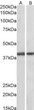 STJ72505 (0. 1µg/ml) staining of Pig Colon (A) and Pig Spleen (B) lysates (35µg protein in RIPA buffer). Primary incubation was 1 hour. Detected by chemiluminescence.