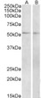 STJ72625 (2µg/ml) staining of Mouse (A) and Rat (B) Small Intestine lysate (35µg protein in RIPA buffer). Primary incubation was 1 hour. Detected by chemiluminescence.