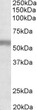 STJ72690 (1µg/ml) staining of Human Placenta lysate (35µg protein in RIPA buffer). Primary incubation was 1 hour. Detected by chemiluminescence.