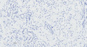 STJ72690 Negative Control showing staining of paraffin embedded Human Kidney, with no primary antibody.