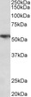 STJ72751 (0. 3µg/ml) staining of Human Lung lysate (35µg protein in RIPA buffer). Primary incubation was 1 hour. Detected by chemiluminescence.
