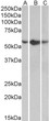 STJ72751 (0. 5µg/ml) staining of A549 (A) , HepG2 (B) and K562 (C) lysates (35µg protein in RIPA buffer). Primary incubation was 1 hour. Detected by chemiluminescence.