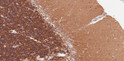 STJ72883 (2µg/ml) staining of paraffin embedded Human Cerebellum. Microwaved antigen retrieval with citrate buffer pH 6, HRP-staining.