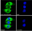 STJ72883 Immunofluorescence analysis of paraformaldehyde fixed A549 cells, permeabilized with 0. 15% Triton. Primary incubation 1hr (10ug/ml) followed by Alexa Fluor 488 secondary antibody (2ug/ml) , showing cytoplasmic staining. The nuclear stain is DAPI (blue). Negative control: Unimmunized goat IgG (10ug/ml) followed by Alexa Fluor 488 secondary antibody (2ug/ml).