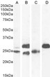 STJ72955 (0. 1µg/ml) staining of Human (A) , (0. 03µg/ml) Mouse (B) , (0. 1µg/ml) Rat (C) and Pig (D) Heart lysate (35µg protein in RIPA buffer). Detected by chemiluminescence.