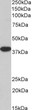 Biotinylated STJ70420 (3. 3µg/ml) staining of Mouse Liver lysate (35µg protein in RIPA buffer) , exactly mirroring its parental non-biotinylated product. Primary incubation was 1 hour. Detected by chemiluminescence, using streptavidin-HRP and using NAP blocker as a substitute for skimmed milk.