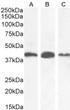 STJ73437 (0. 03µg/ml) staining of Human Kidney (A) , (0. 1ug/ml) Liver (B) and (1ug/ml) Colorectal cancer (C) lysate (35µg protein in RIPA buffer). Detected by chemiluminescence.