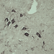 IHC on rat spinal cord using Rabbit antibody to VPS45A (STJ13100462) at a concentration of 10 ug/ml. Pre-absorption of the antibody with the immunising peptide completely abolishes the immunostaining (not shown) .